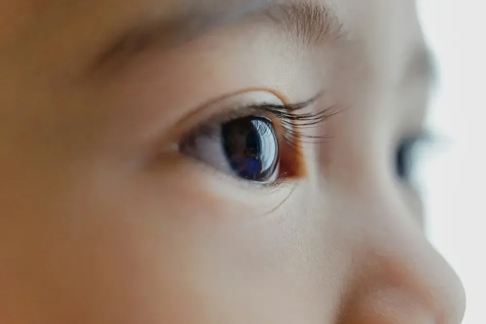Lunettes astigmatisme enfant